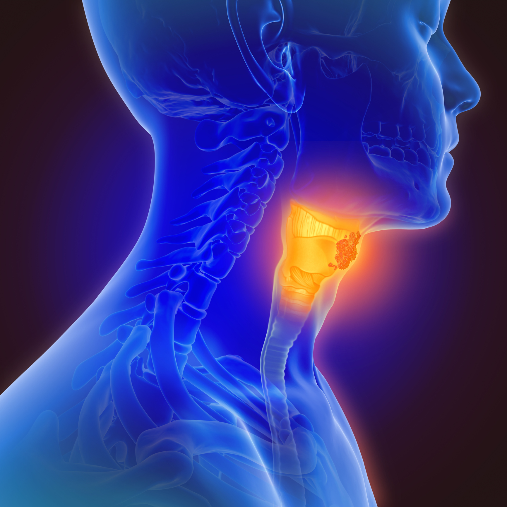 burning-in-throat-causes-remedies-centre-for-gi-health